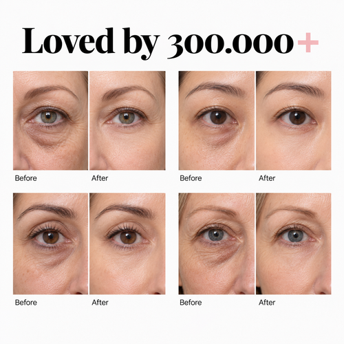 PDRN + Collagen Peptide Eye Patches